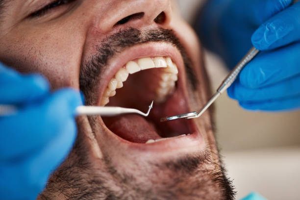 Best Emergency Treatment for Dental Infections or Abscesses in Warroad, MN
