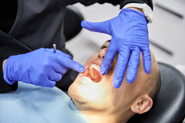 Best Emergency Dental Care for Broken or Chipped Teeth in Warroad, MN