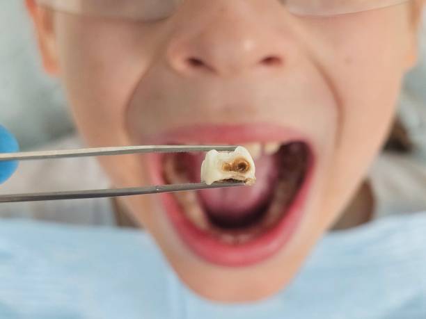 Best Pediatric Emergency Dentist in Warroad, MN